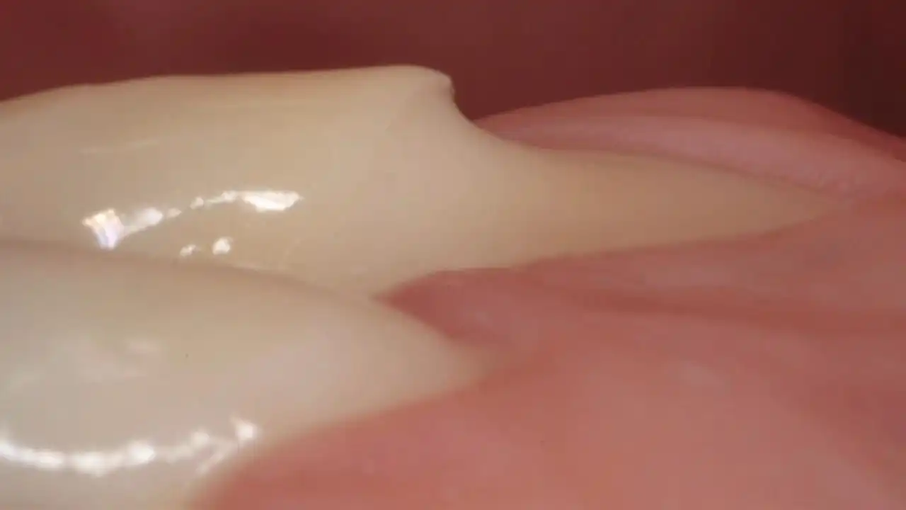 Surgical resolution of single gingival recession on natural teeth in ...