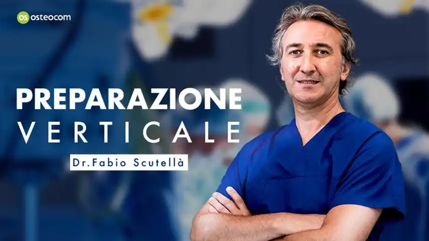 Preparazione Verticale