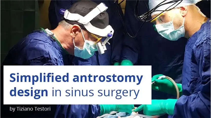 Simplified antrostomy design in sinus surgery