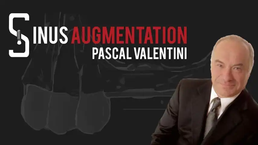 Sinus Augmentation International