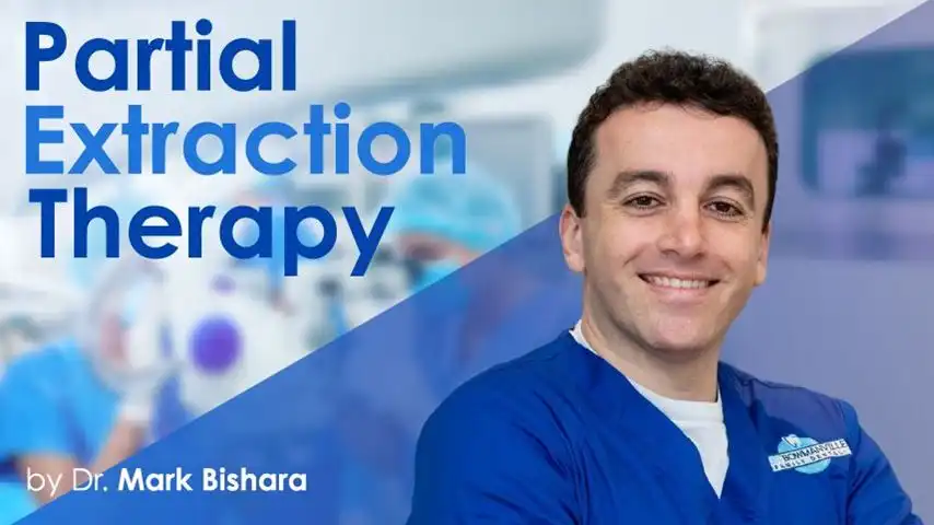 Partial Extraction Therapy