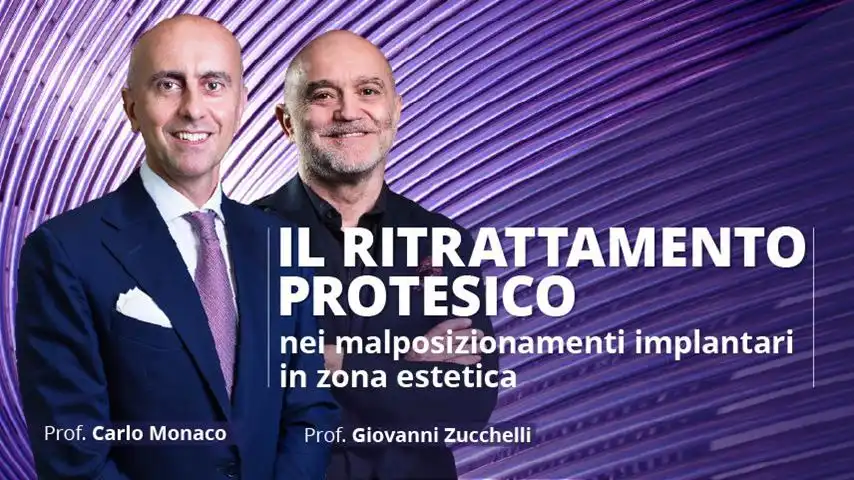 Il ritrattamento protesico nei malposizionamenti implantari