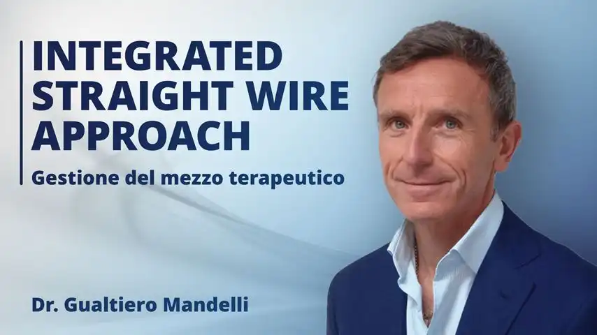 Integrated Straight Wire Approach