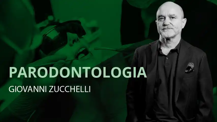 Tecnica della parete connettivale per il trattamento delle recessioni interdentali in zona 11 e 12