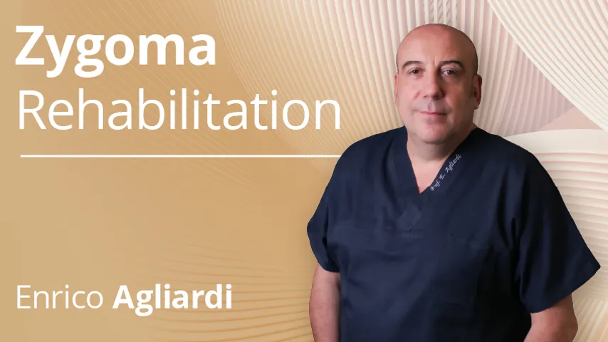 Zygoma Rehabilitation