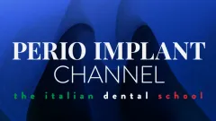 Perio Implant Channel