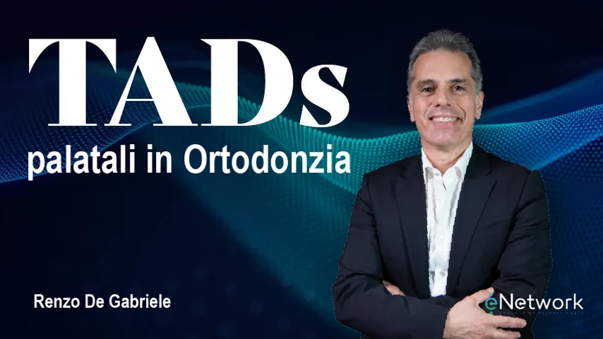 TADs palatali in Ortodonzia