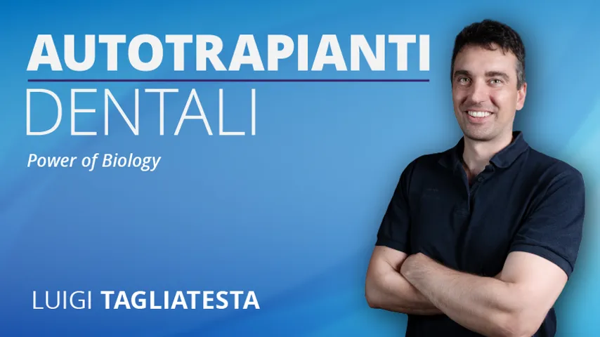 Autotrapianti dentali