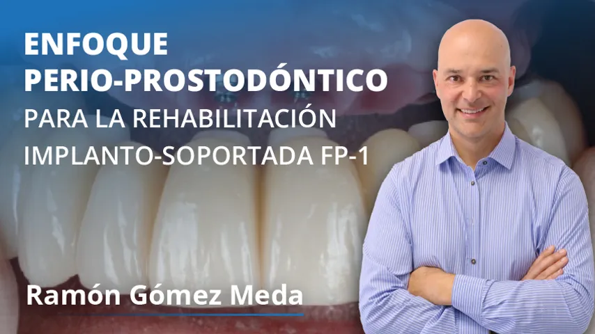Enfoque perio-prostodóntico para la rehabilitación implanto-soportada FP-1