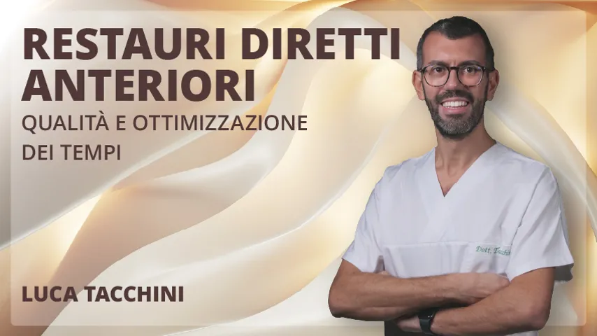 Restauri Diretti Anteriori 