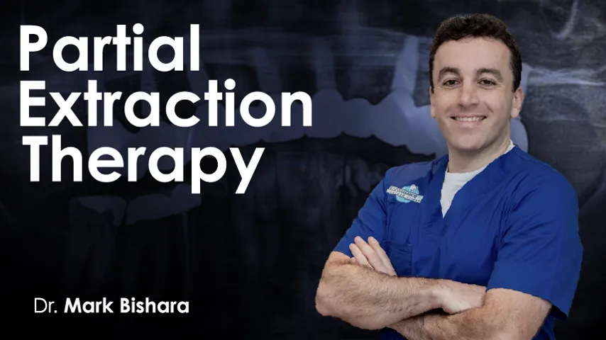 Partial Extraction Therapy 2024