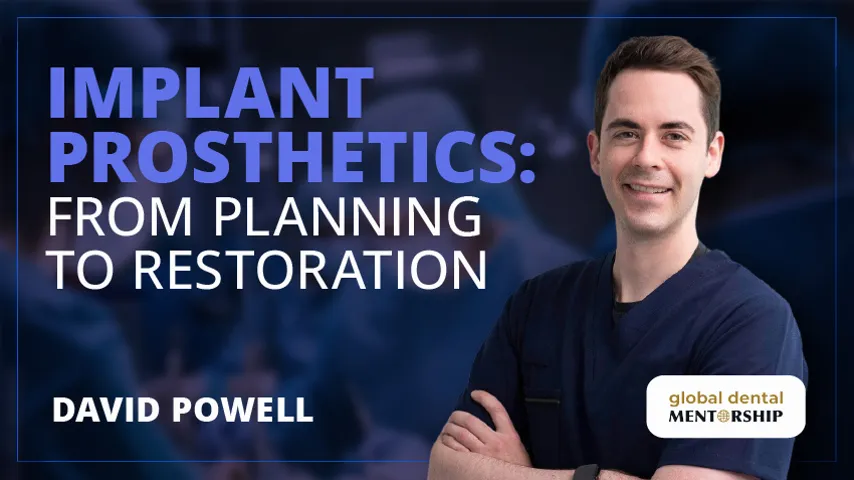 Implant Prosthetics: from Planning to Restoration