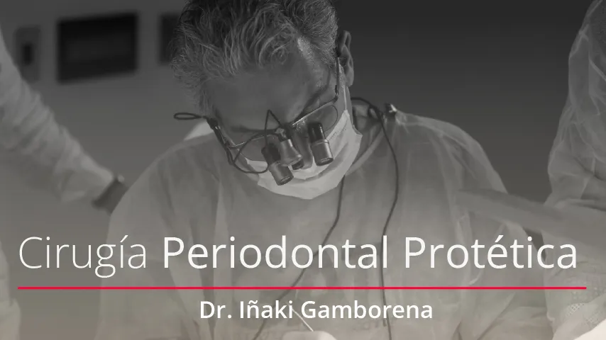 Cirugía Periodontal-Protetica