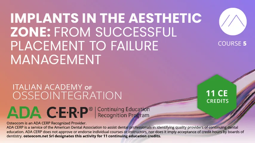 Implants in the Aesthetic Zone: From Successful Placement to Failure Management - Ada Cerp