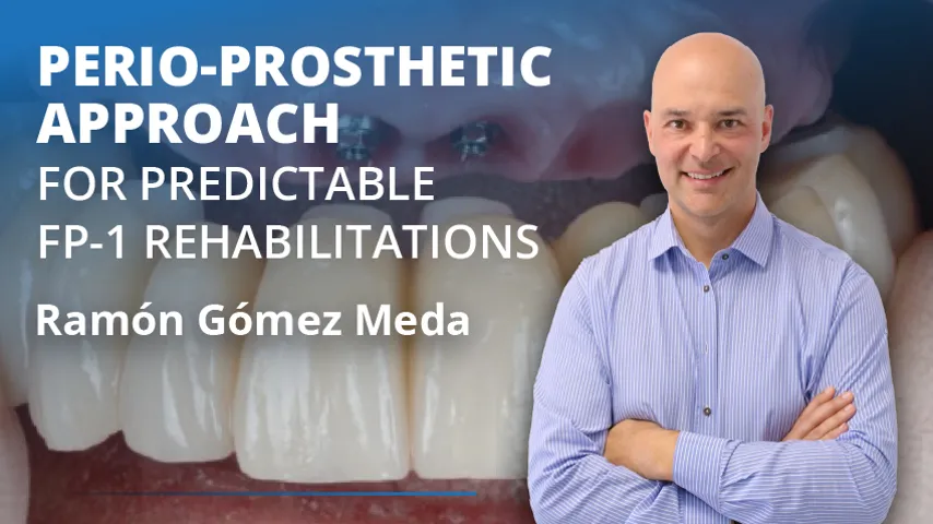Perio-Prosthetic Approach for FP-1 Rehabilitations