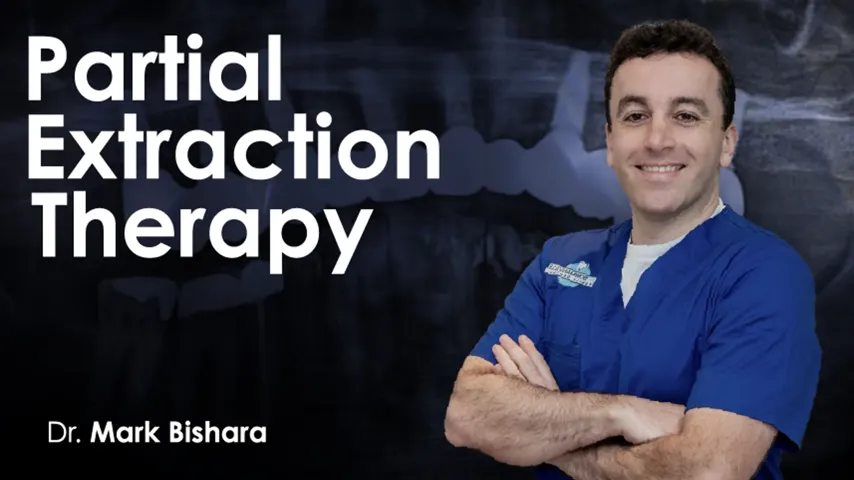 Partial Extraction Therapy 2024