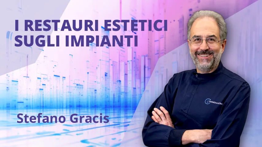 I restauri estetici sugli impianti