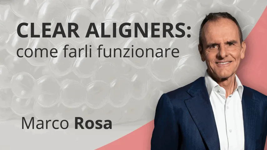 Clear Aligners: come farli funzionare
