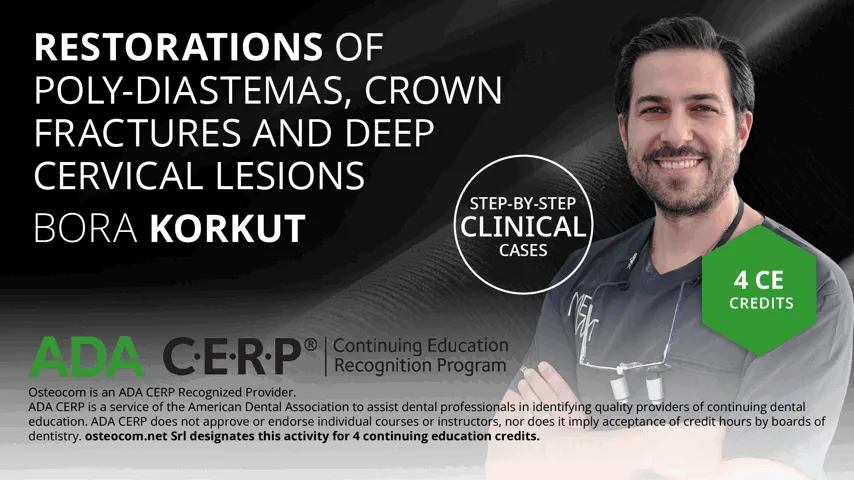 Restorations of Poly-Diastemas, Crown Fractures and Deep Cervical Lesions - ADA CERP