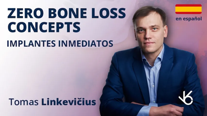 Zero Bone Loss Concepts - Implantes Inmediatos