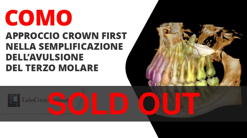 Approccio Crown First nella semplificazione dell’avulsione del terzo molare - seconda edizione Novembre 2026