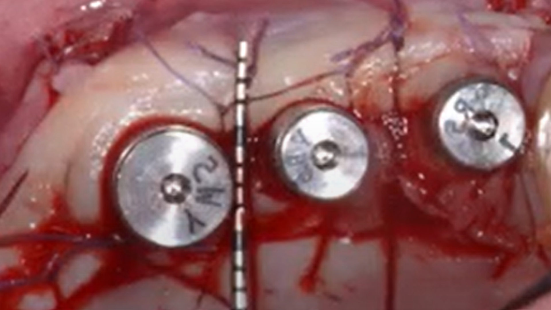 Clinical conclusions