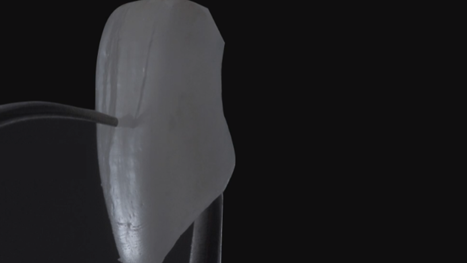  Introduction and classification according to MIPP concept