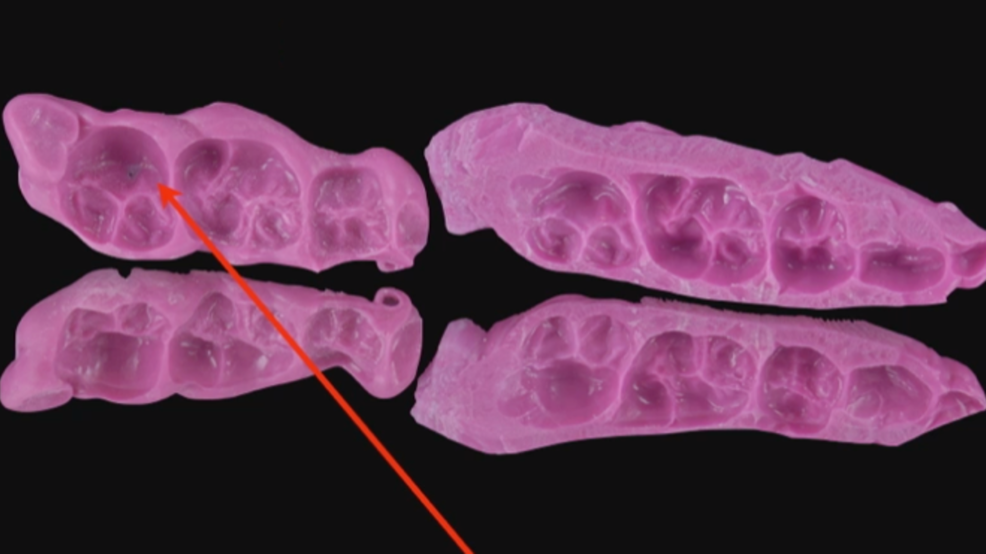 The centric relation according to MIPP concept