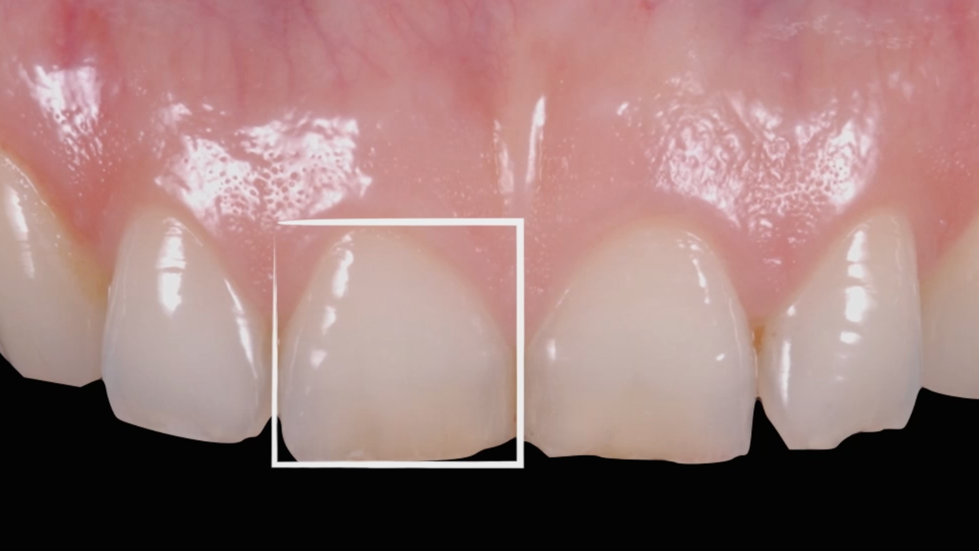 Clinical case - MIPP 3 (part 1 of 3): treatment planning and data collection